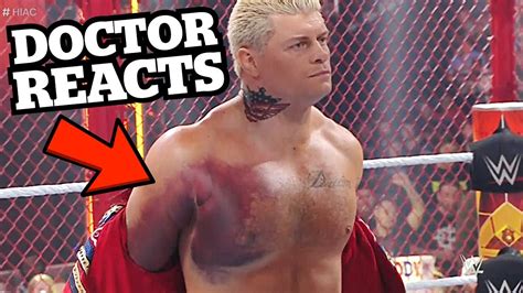 20 Jul 2022 ... Seth Rollins Details Seeing Cody Rhodes' Torn Pectoral Muscle At WWE Hell In A Cell. Cody Rhodes wrestled the match with a nasty injury. By ...